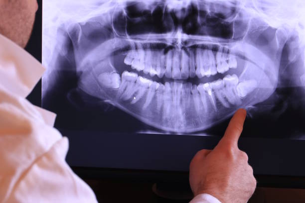 Best Emergency Dental Surgery in Kingsley, IA